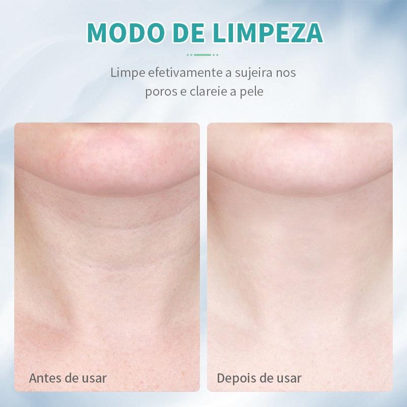 Massageador Facial com Led Terapia 3 em 1 - Rejuvenesce, Acaba com Manchas e Acnes, Impurezas e Papada